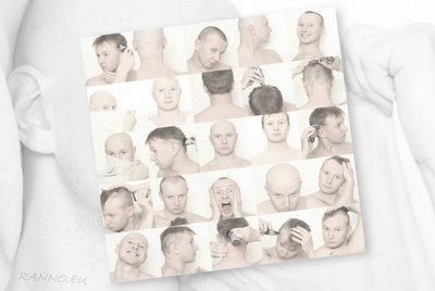Progression of self-inflicted baldness